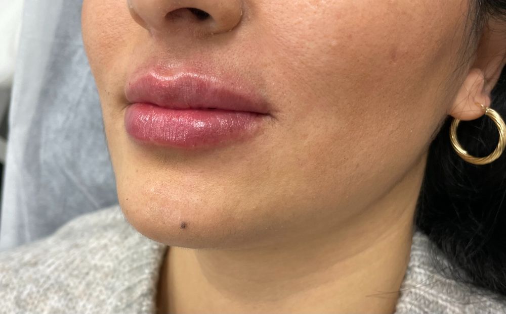 Russian lips 5